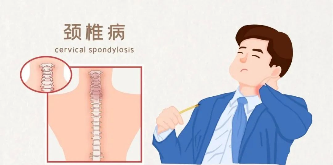 67中醫科普丨預防頸椎病拒做低頭族