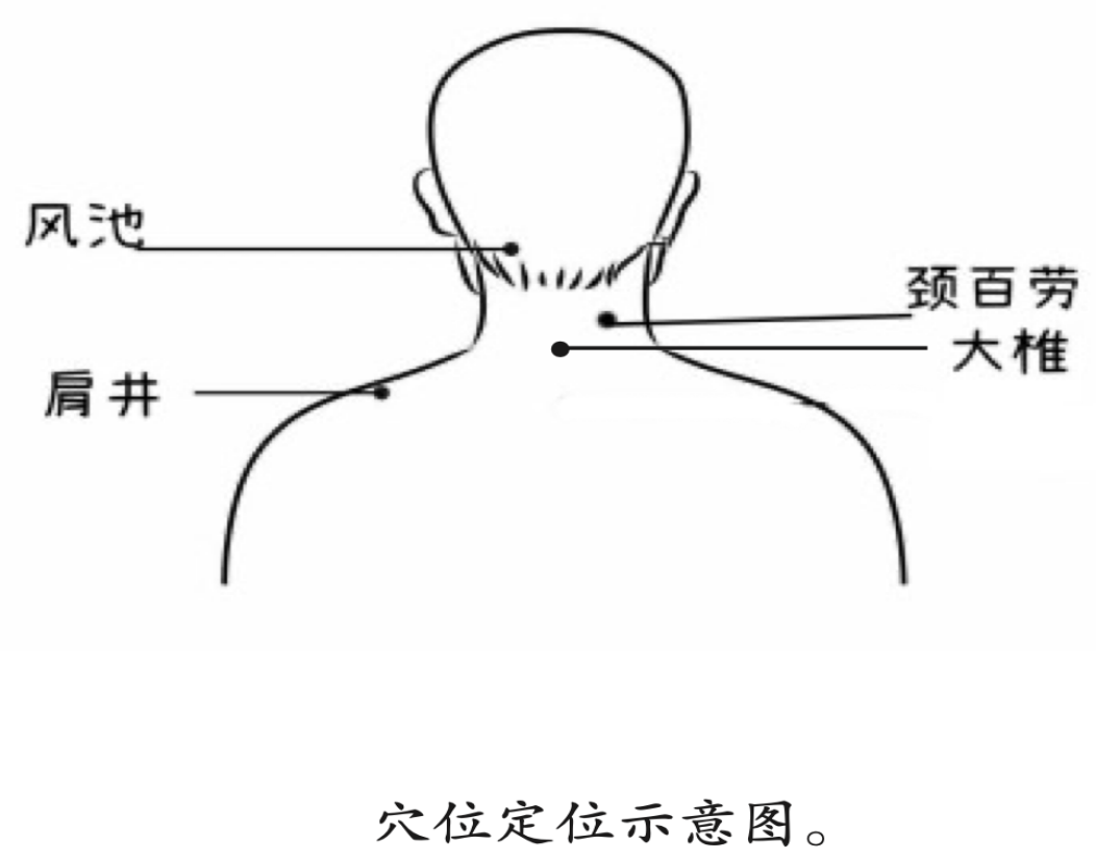 頸部不適伴有頭暈,頭痛時可按揉,以局部酸脹感為度.2.